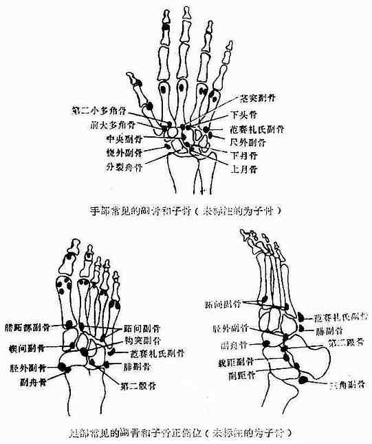 手、足骨骼之解剖变异