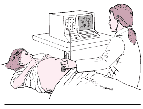 超声扫描