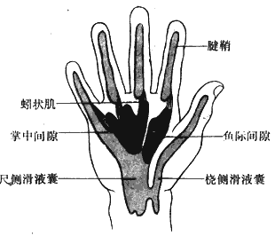 手屈指肌腱鞘、滑液囊和手掌深部间隙的解剖位置示意图