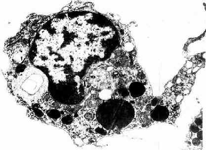 图3-5 巨噬细胞超微结构立体模式图
