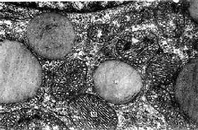 猴肾上腺皮质束状带细胞电镜像