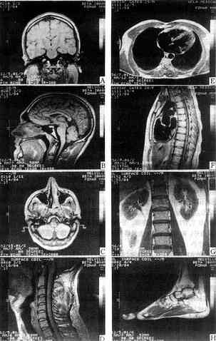 不同器官结构的MRI